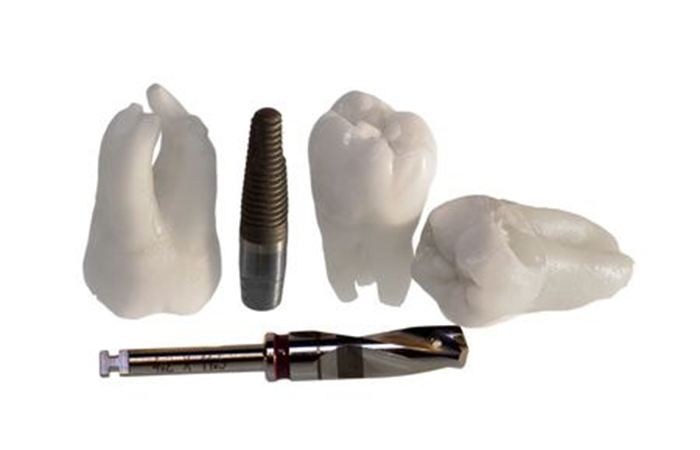 Steps involving an implant