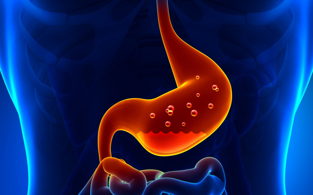 Does acid reflux affect your teeth?